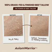 AxiomWarrior Beef Tallow Skin Care: Whipped Organic Beef Tallow Moisturizer Cream for Face & Body with Grass Fed & Finished - Hydrates, Smoothes, Nourishes Skin - Sensitive, Dry Skin - 2oz