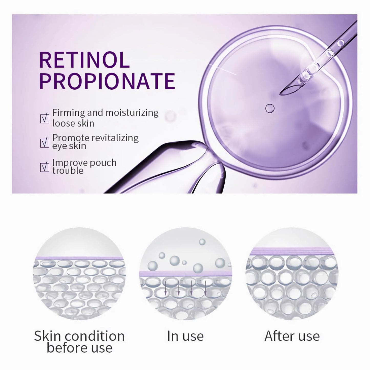 mercham Retinol Eye Cream Anti Aging, Under Eye Cream with Cooling Roller for Dark Circles and Puffy Eyes Bags, Reduce Fine Lines, Brightening & Moisturizing Eye Repair Cream for all Skin Types- 20g