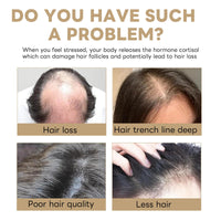 GMHLLES Hair Loss Shampoo Set Mane Root Activator Shampoo for Men Anti-Hair Loss,with nourishing Conditioner+foaming Net,Mane for Men Unisex