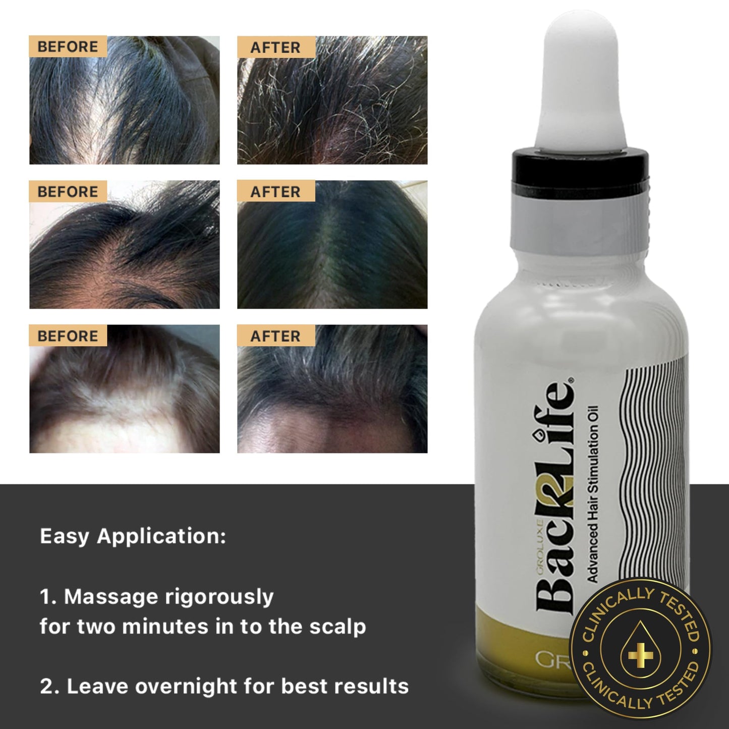 Back2Life Hair Back2Life 100% Natural Hair Stimulation & Beard Growth Oil-Get Rid of Patchy Beards & Hair-Beard serum to Moisturise, Hydrate & Condition-Repair & Rebalance Your Scalp & Regrow your Head & Beard Hair