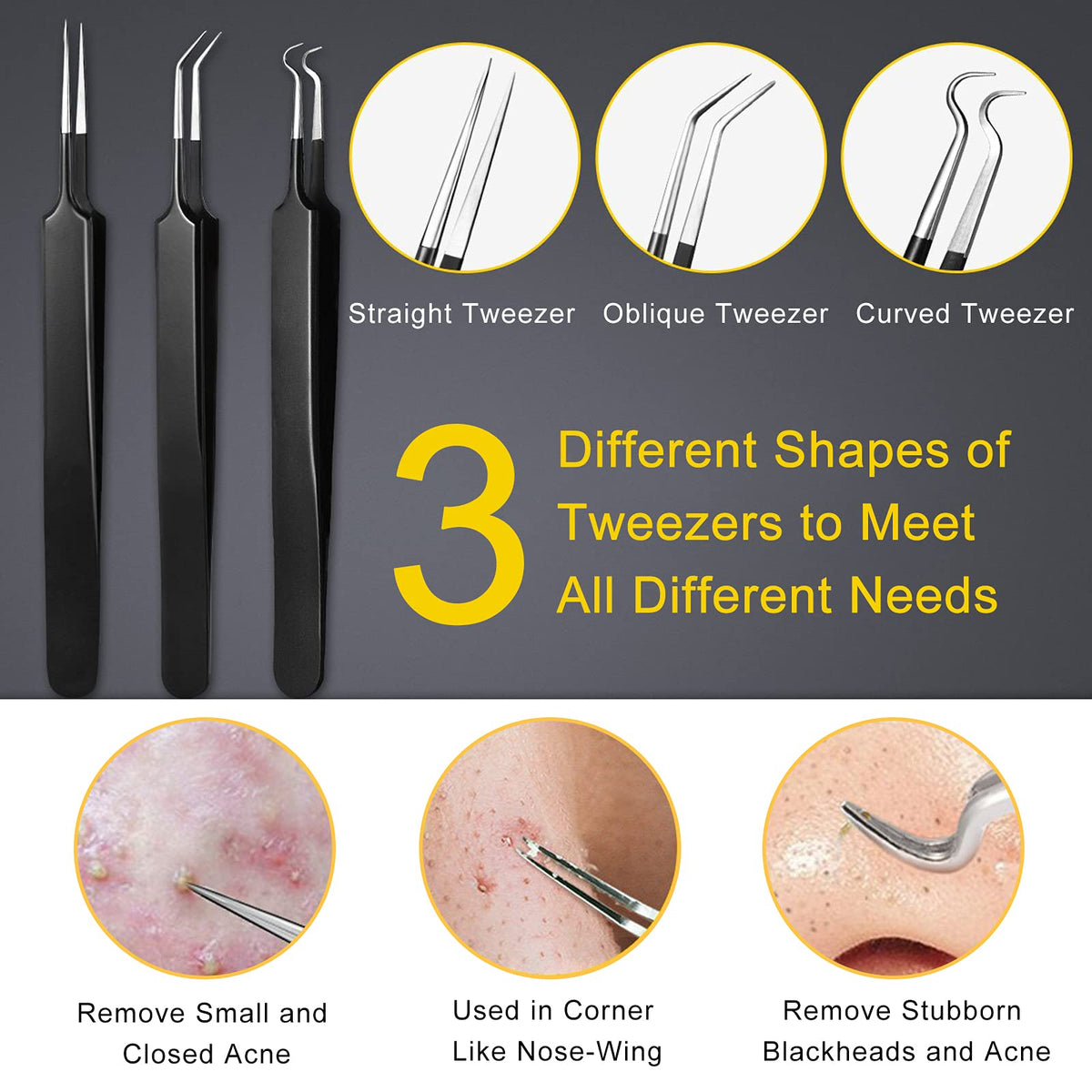 Boxoyx Pimple Popper Tool Kit - 10Pcs Blackhead Remover Comedone Extractor Tool Kit with Metal Case for Quick and Easy Removal of Pimples, Blackheads, Zit Removing, Forehead, Facial and Nose(Black)