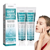 Nadiaen 2 Pcs Dark Spot Remover for Face,Age Spot Remover Hyperpigmentation Treatment-Sun Spots and Melasma Treatment Cream for Face, Pigmentation Freckle Removal Cream
