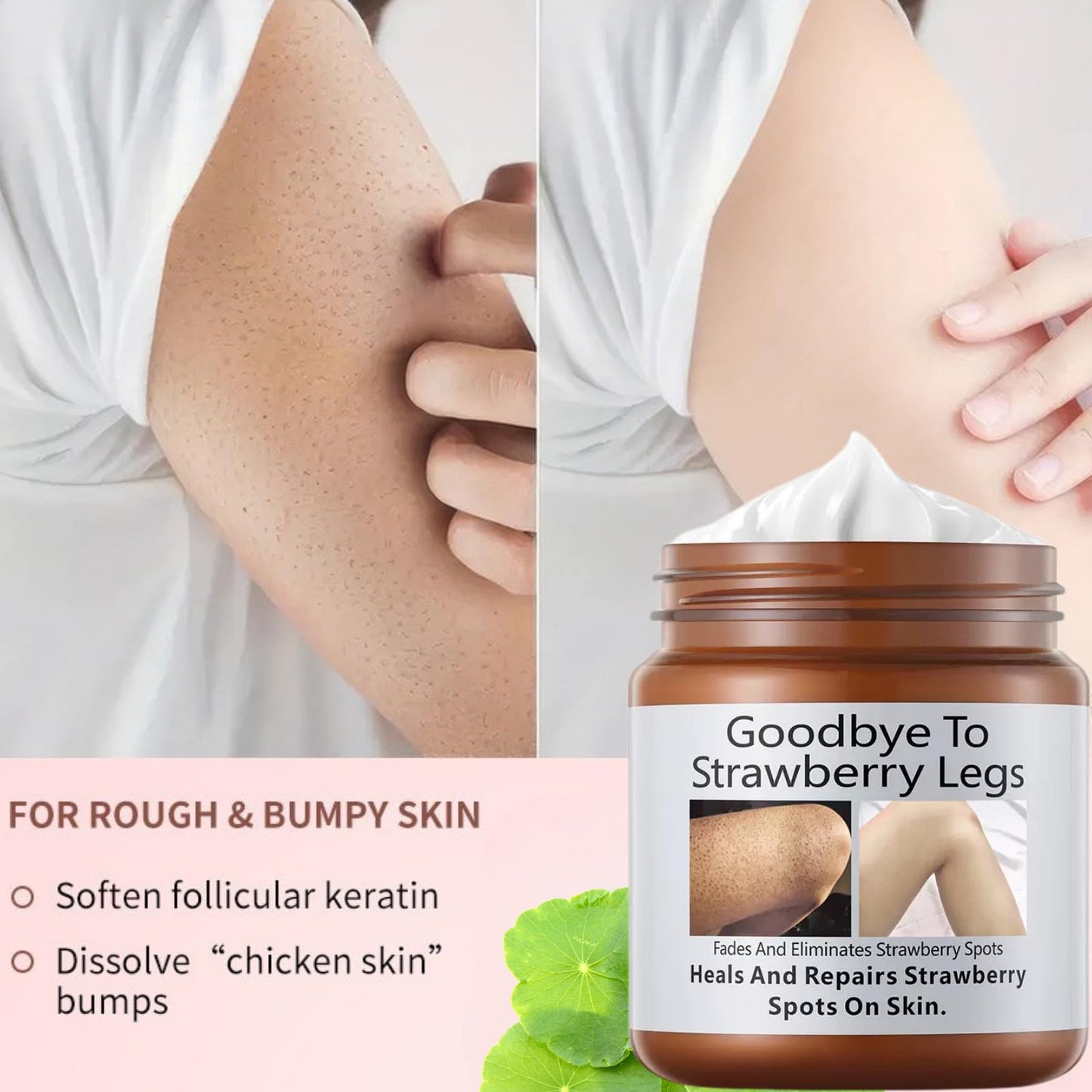 jinyue S-trawberry S-kin Treatment,Strawberry Legs Treatment,Keratosis Pilaris Cream，Keratinization & Exfoliating Body Cream for Bumpy Skin, Chicken Skin & Strawberry Spots Repair120g