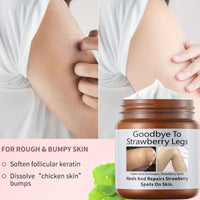 jinyue S-trawberry S-kin Treatment,Strawberry Legs Treatment,Keratosis Pilaris Cream，Keratinization & Exfoliating Body Cream for Bumpy Skin, Chicken Skin & Strawberry Spots Repair120g