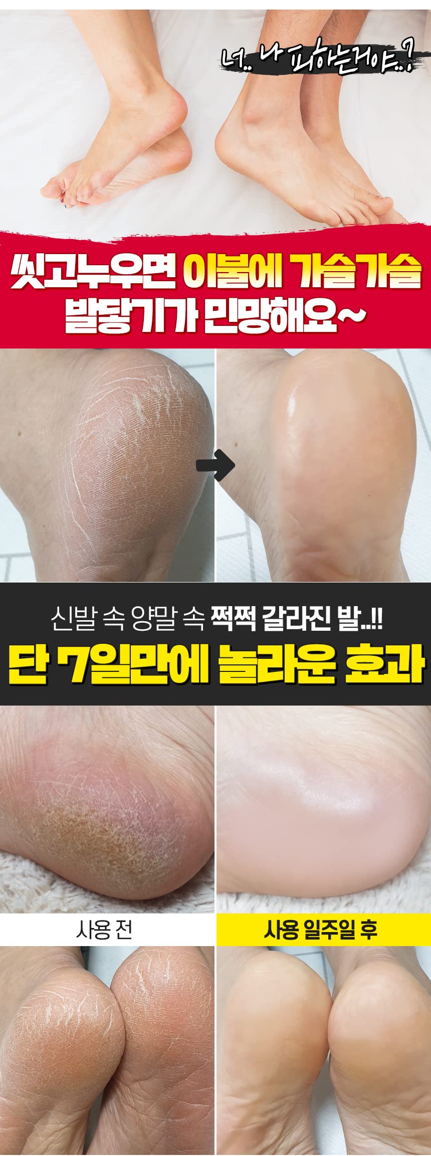 Bonnyhill | Collagen Foot Cream | Intensive Hydration | Dry Skin | 100ml