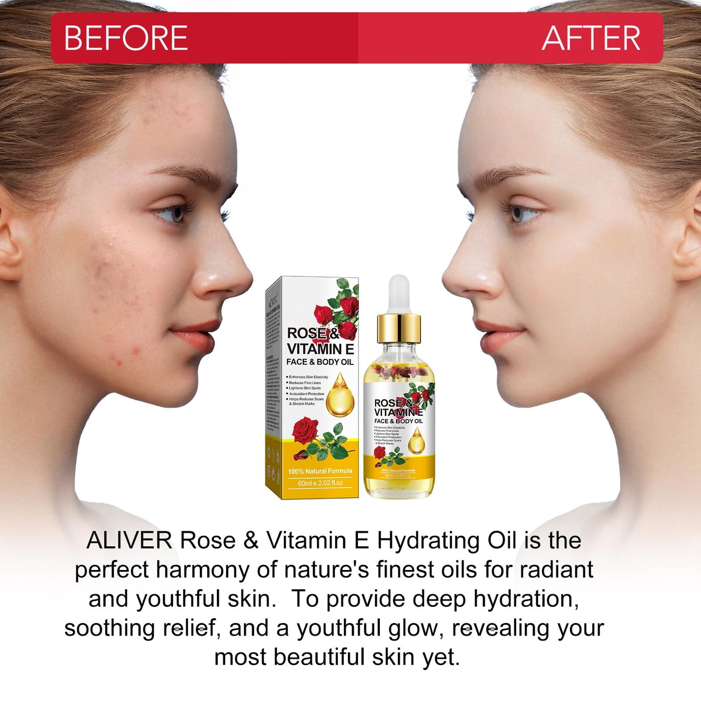 Rose Vitamin E Face & Body Oil - 100% Natural Moisturize Reduce Wrinkles Diminish Scars and Stretch Marks Enhances Skin Elasticity Rose Vitamin E Oil Organic for Face Body Massage Oil