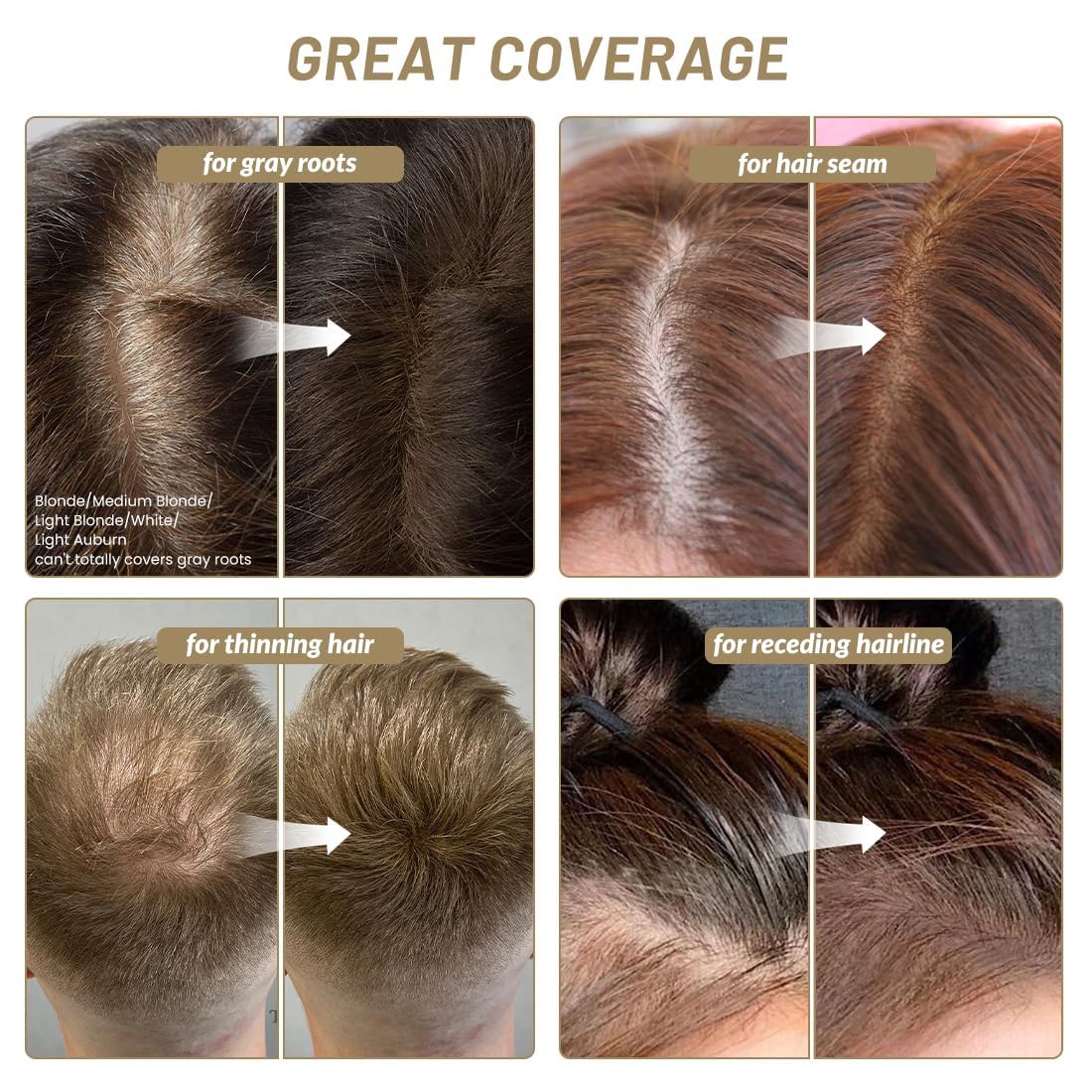 SOVONCARE Root Touch Up Powder,Root Cover Up Hair Powder for Women for Thinning Hair & Conceals Hair Loss,Hairline Powders Instantly Hairline Shadow Cover (Medium Brown, 0.14 Ounce (Pack of 1))
