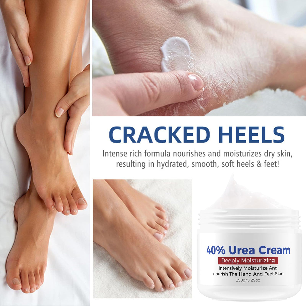 Shengqialun Urea Foot Cream, Urea Cream 40 Percent For Feet, Foot Cream for Cracked Heels and Dry Skin, Urea Cream for Hand,Foot and Body Care Deep Moisturizing Callus Remover Nourishes Soften
