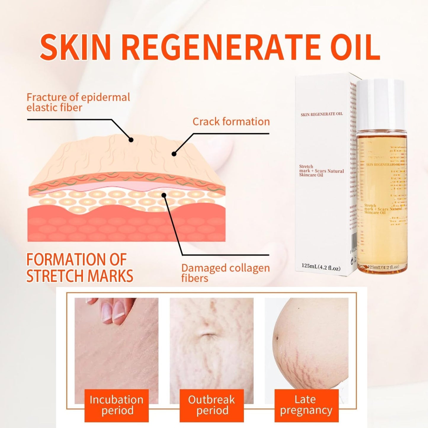 IZBEAUVO Body Skin Care Oil, Stretch Mark & Scar Oil for Women, Stretch Marks Removal Skin Regenerating Body oils, Skin Regenerate oil with Chamomile, Vitamin E, Lavender Improves Elasticity 125ML