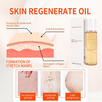 IZBEAUVO Body Skin Care Oil, Stretch Mark & Scar Oil for Women, Stretch Marks Removal Skin Regenerating Body oils, Skin Regenerate oil with Chamomile, Vitamin E, Lavender Improves Elasticity 125ML