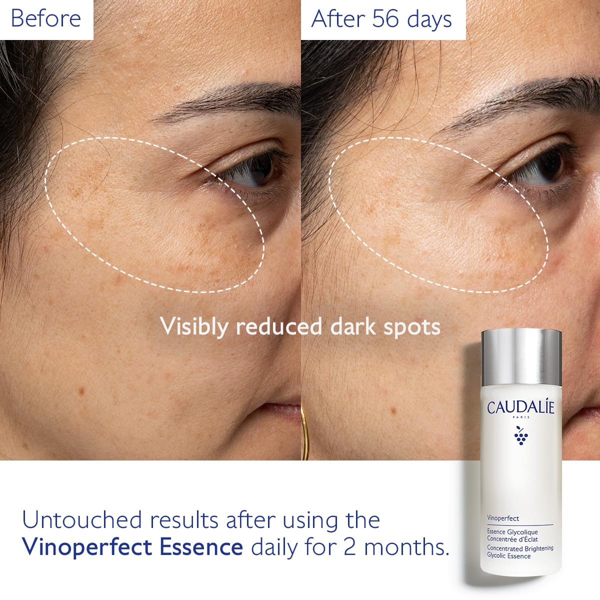 Caudalie Vinoperfect Concentrated Brightening Glycolic Essence, 100ml