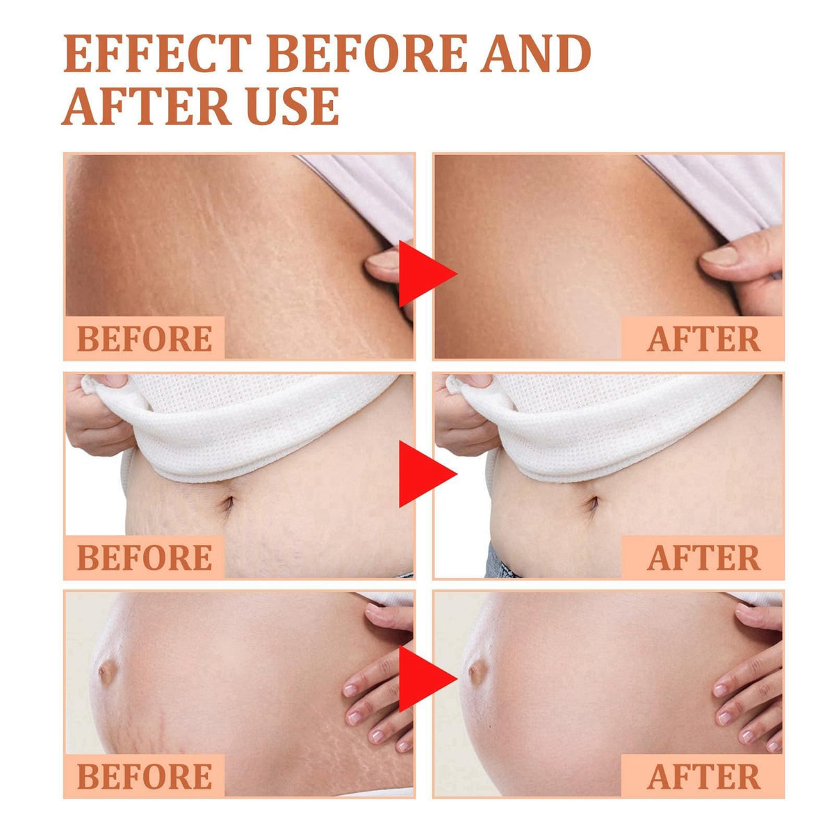 LaluluTek Stretch Mark Treatment Oil for Women - Optimal Formula for Removal of Stretch Marks, Scars, Firming & Lifting Body Care, 50ml