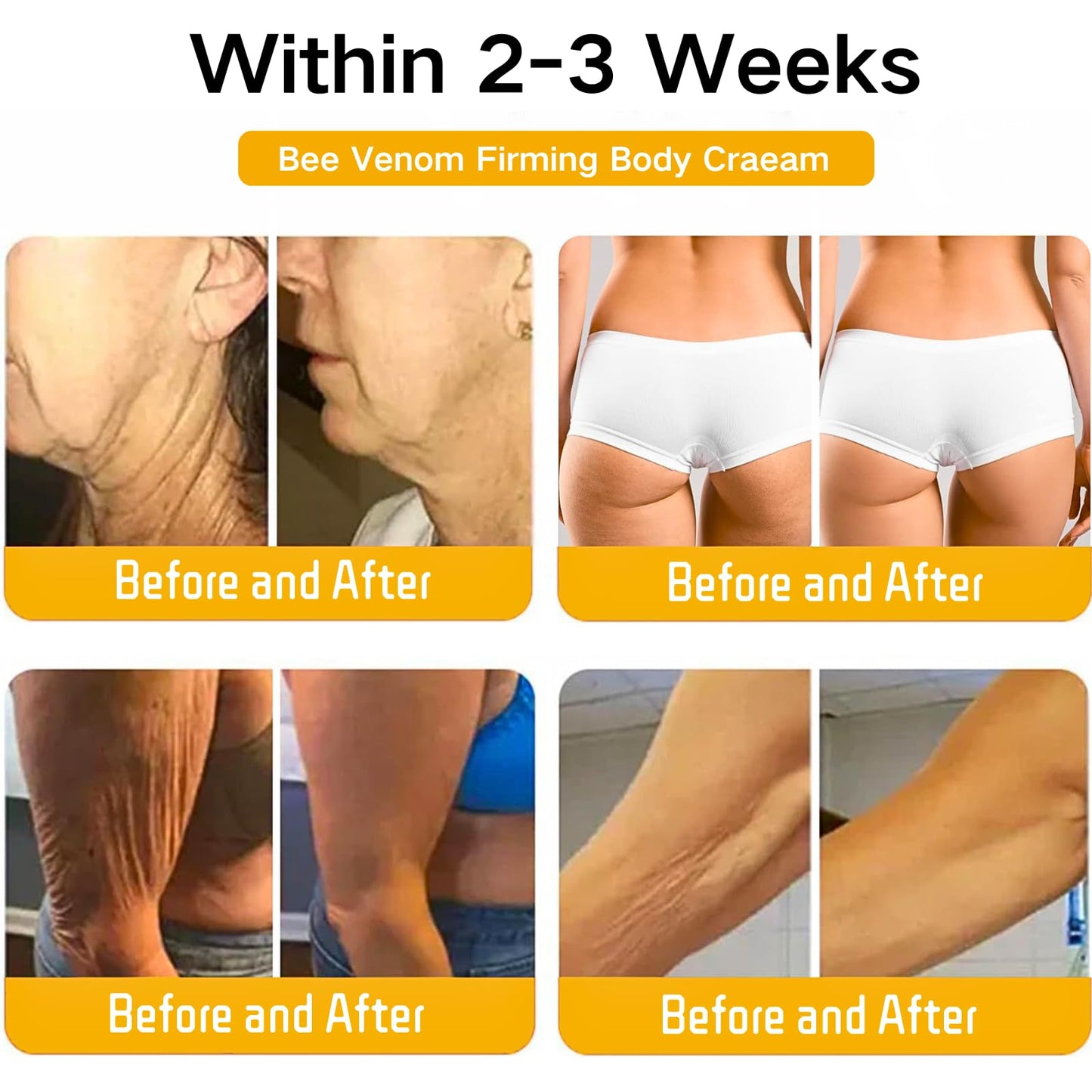 IZBEAUVO Bee Lift Anti Aging Firming Body Cream, Bee Venom Wrinkle Removal Cream, Collagen Firming Body Lotion, Neck FirmingCream For Loose Skin, Skin Tightening CreamBody, Restore Elasticity, Hydration