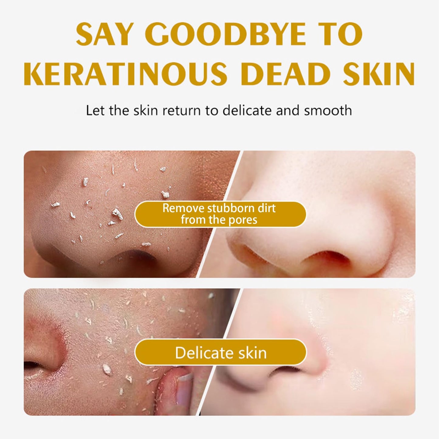 Facial Exfoliator, Vitamin C Exfoliating Gel, Lemon Peeling Gel Removes Dead Skin, Moisturizing Facial Scrubs Anti Pigmentation for All Body Parts