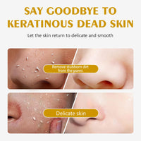 CTUBLIAUNX Facial Exfoliator, Vitamin C Exfoliating Gel, Lemon Peeling Gel Removes Dead Skin, Moisturizing Facial Scrubs Anti Pigmentation for All Body Parts