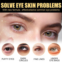 SingHao 2 Pcs Lutein Eye Essence Oil,Lutein Eye Wrinkle Essence Oil,Vitamin C Lutein E/ye Essen/ce O/il,Vc E/ye Wrinkle Essen/ce O/il,Lu/tein Essential O/il,L/utein Rollerball Ess/ence,E/ye Bags Remover