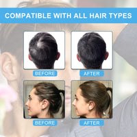 sefudun Natural Hair Building Fibres (DARK Brown) , Hair Fibres Powder for Thinning Hair, Instantly Fill in 15 Sec Women & Men 4 Shades- Hair Thickener and Topper for Fine Hair