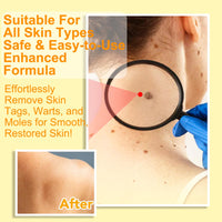 Generic Bee Venom Cream, 2024 New Upgrade Bee Venom Treatment Cream, for Wrinkles and Dry Skin & Dry Skin Bee Venom Wart & Moles Removal Cream Skin Moisturiser -Bee Venom All in One Cream for Body & Face Bee