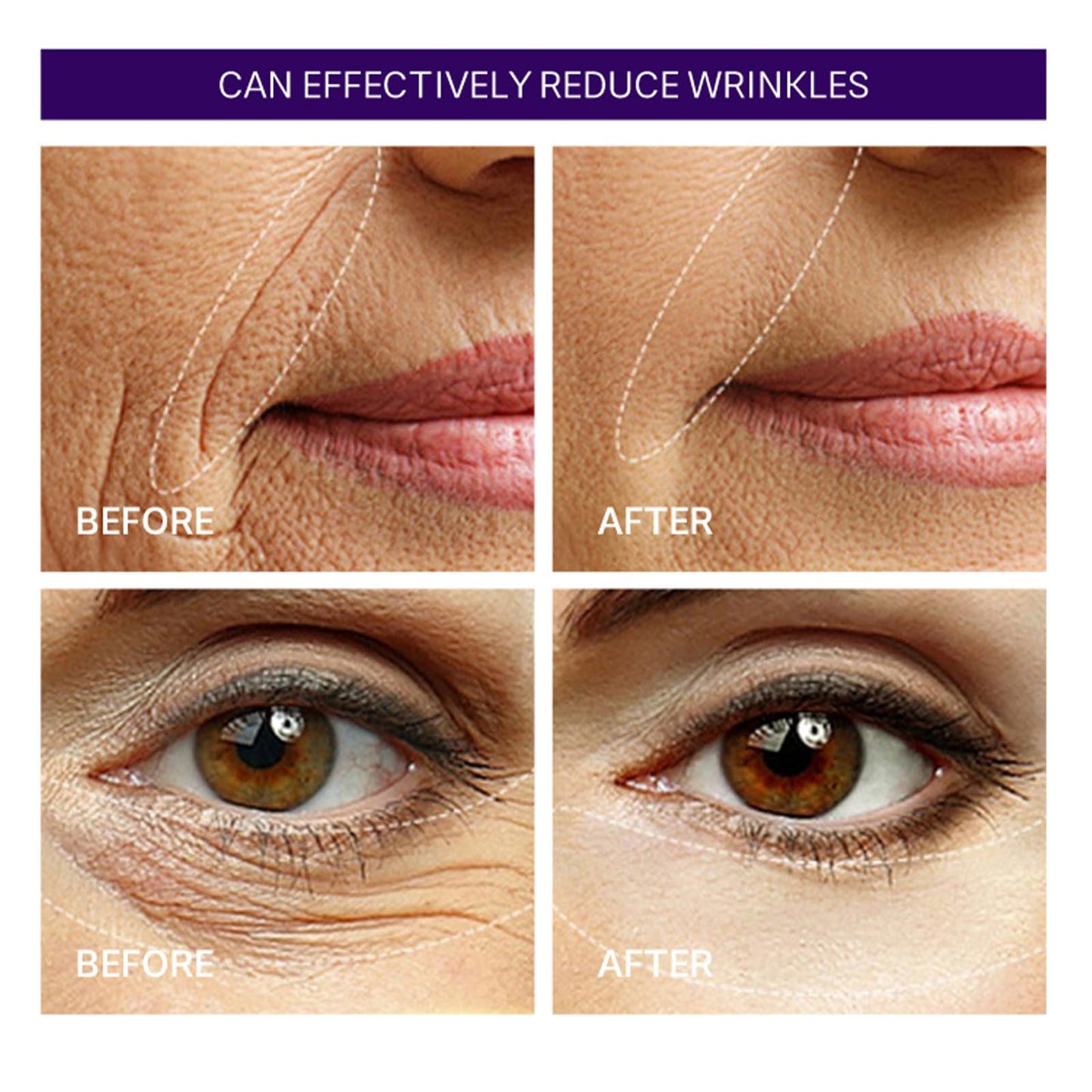 Tongyend Retinol Intense Reactivating Serum, Retinol Serum For Face - Resurfacing Retinol Serum, Barrier Serum For Anti Aging & Wrinkle Reduction, Retinol Moisturiser Face Serum For Women Mature Skin