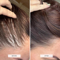HAIR BURST Biotin Gummies for Hair Growth — Hair, Skin & Nails Vitamin Supplement, Reduces Breakage, Promotes Healthier Thicker- Daily Chewable Vitamins - 30 Day Supply