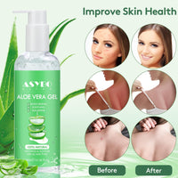 ASYBO 300 ml Aloe Vera Gel, 100% Natural Pure Aloe Vera Hydrating Facial Moisturizer, After Sun Care, Reduce Acne, Repair Scars, Suitable for All Skin Types