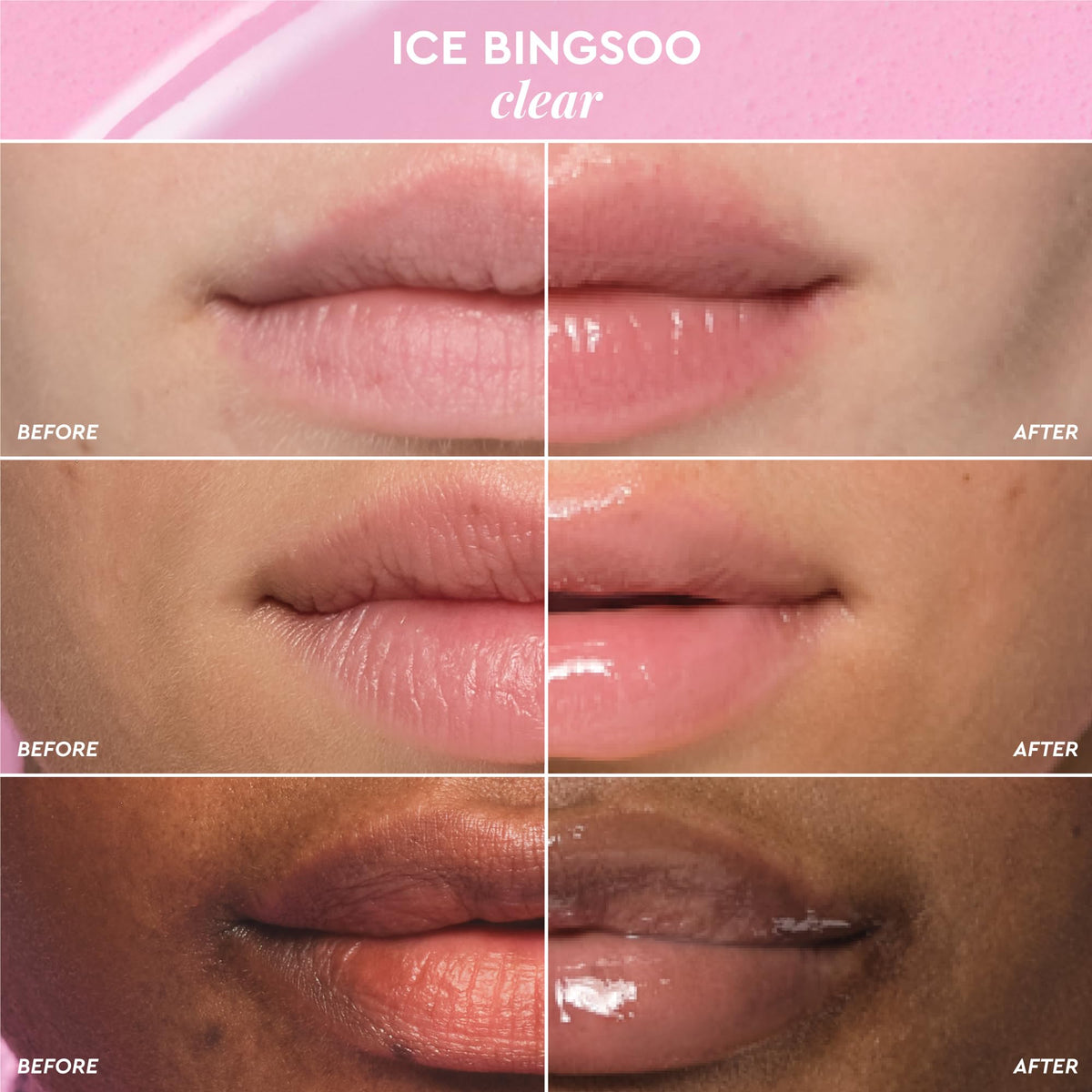 Glow Recipe Glass Balm Lip Treatment - 12Hr Hydrating Lip Balm & Moisturizer with Hyaluronic Acid to Smooth, Plump & Protect from Dryness, High Shine Finish - Clear Tint, Ice Bingsoo (15 ml)