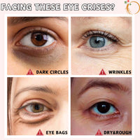 Revive Eye Serum: Ginseng + Retinal, Advanced Eye Cream for Dark Circles And Puffy Eyes, Hydrating Anti Wrinkle Eye Creams, Eyes Cream Anti Aging for Wonen&Men, Korean Skincare, 30ml