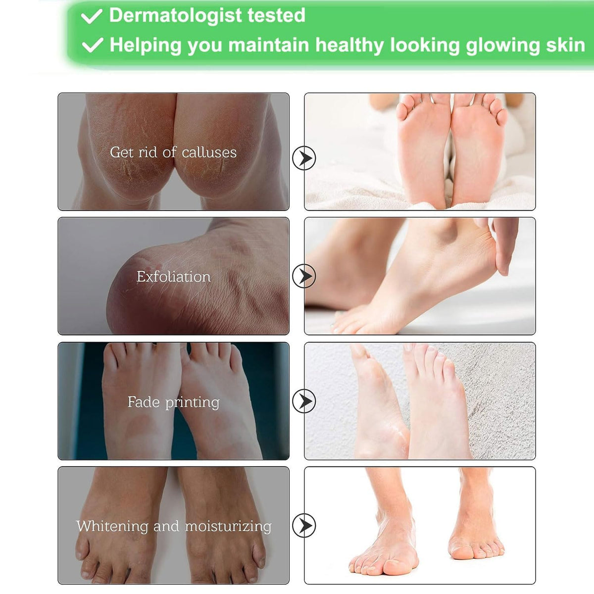 HOKIAMCN Foot Mask 5 Packs, Foot Peel Mask Callus Remover, Exfoliating Peeling Calluses Dead Skin, Callus Remover Foot Mask, Baby Soft Smooth Touch Feet-Men Women Exfoliating Foot Mask (Rose)