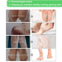 HOKIAMCN Foot Mask 5 Packs, Foot Peel Mask Callus Remover, Exfoliating Peeling Calluses Dead Skin, Callus Remover Foot Mask, Baby Soft Smooth Touch Feet-Men Women Exfoliating Foot Mask (Rose)