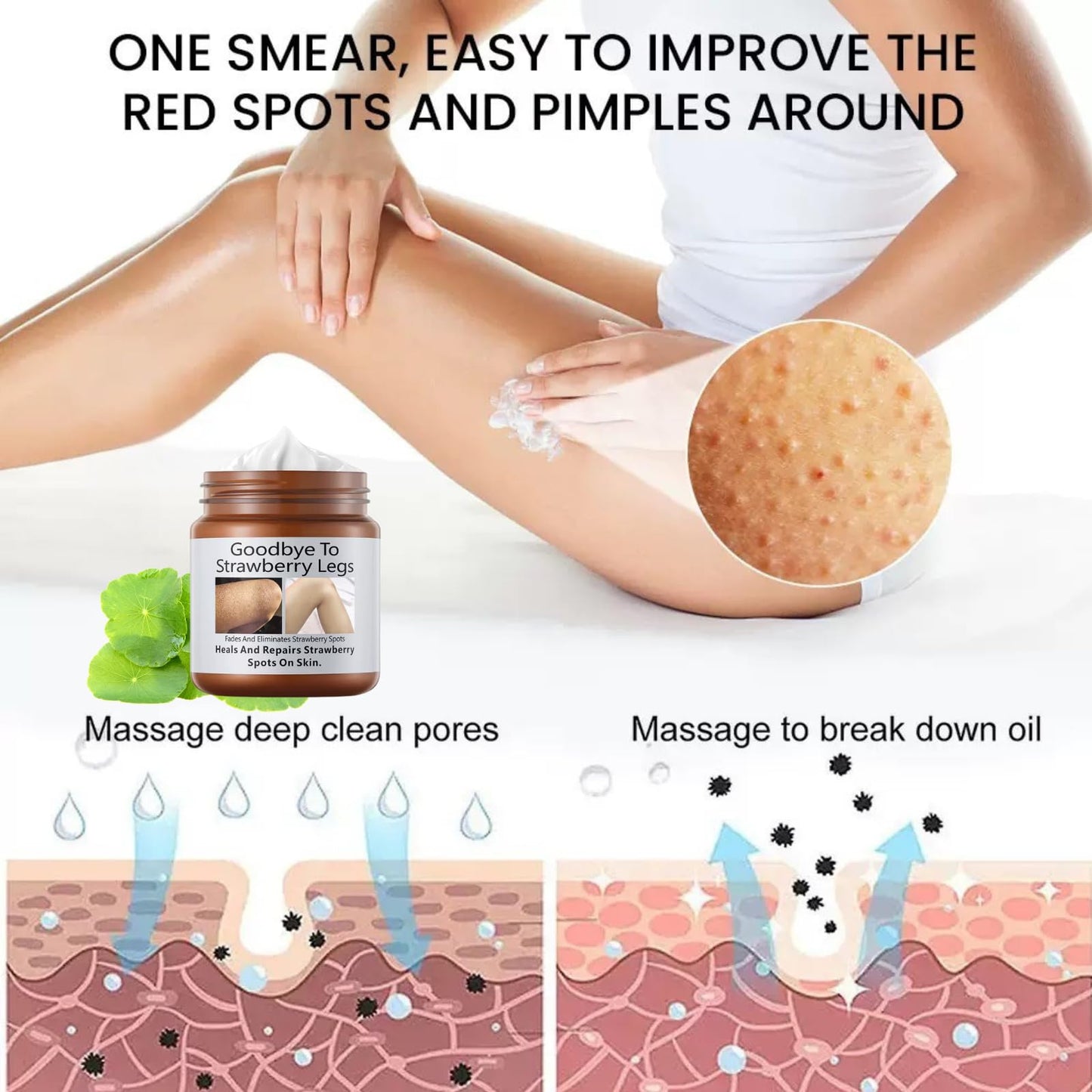 jinyue S-trawberry S-kin Treatment,Strawberry Legs Treatment,Keratosis Pilaris Cream，Keratinization & Exfoliating Body Cream for Bumpy Skin, Chicken Skin & Strawberry Spots Repair120g