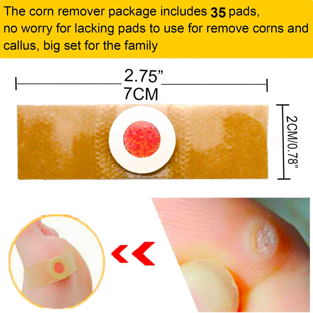 Mcvcoyh Corn Removal 35 Pieces Corn Remover Pads Wart Remover Callus Cushions Treatment Relief Corn Pain and Foot Care