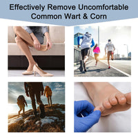 mercham Wart Remover & Verruca Treatment, 24 Pads Corn Remover Pads for Feet, Hands, Gentle & Safe on Skin, Fast & Pain Relief, Wart Treatment Plasters Effective for Kids Adults