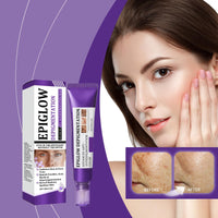 HERBENJOY Pigmentation Removal Cream, Anti-Hyperpigmentation Cream, Skin Advanced Creams, Anti-Ageing Face Hyperpigmentation Treat for All Type Skin, 20g