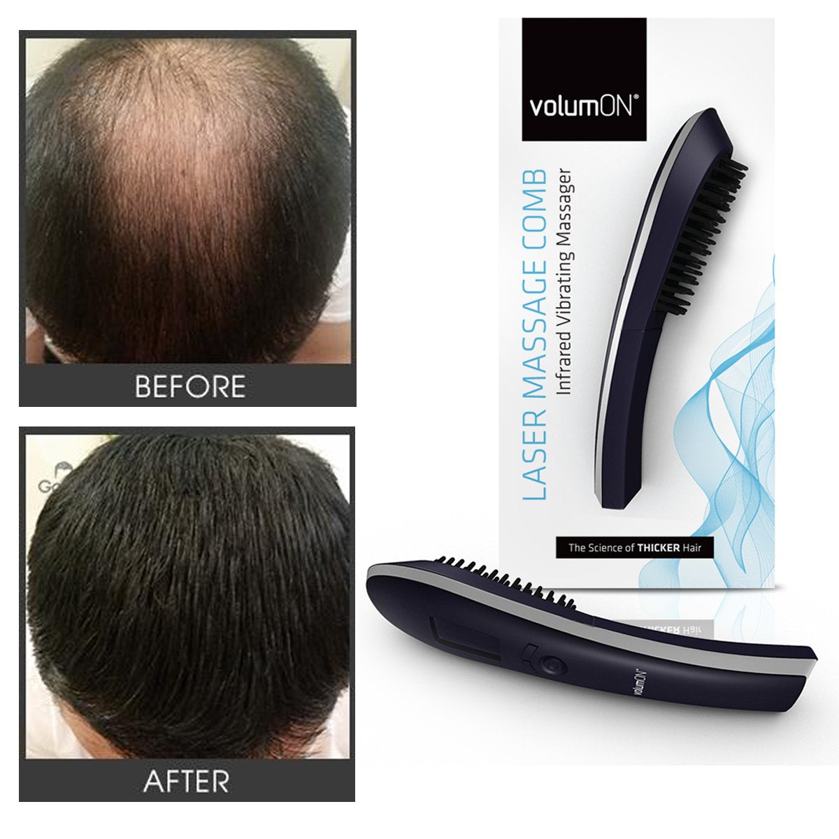 Volumon Electric Laser Massage Comb For Hair Growth Regrowth Hair Thickening & Strengthening With Massager & Infrared & Digital LCD Screen- Daily Home Use