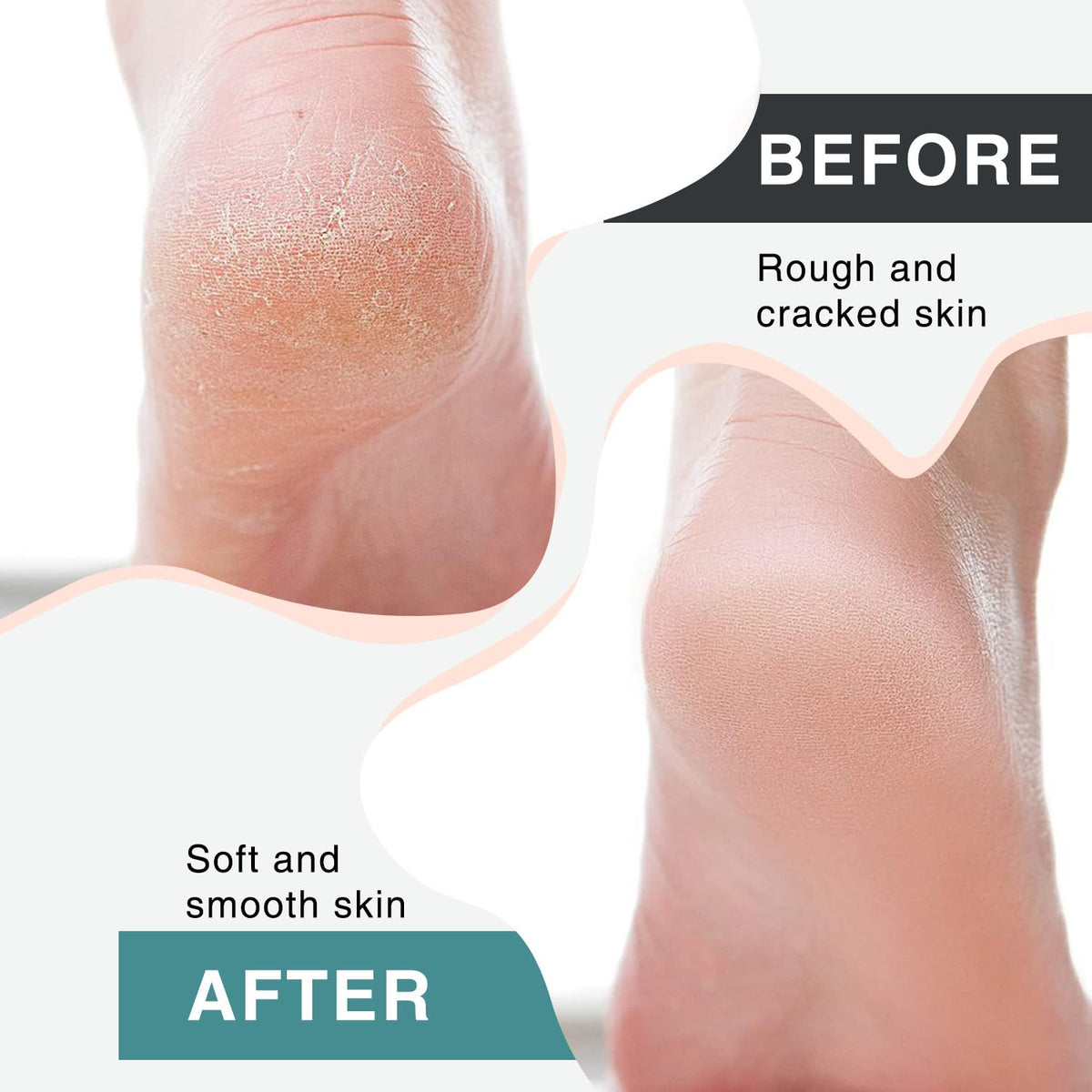 atnayo Electric Foot File Hard Skin Remover, Clean Brush and Foot Sander for Hard Skin Callus Dry
