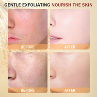 INSKIN Peel Shot Glow Rice Ampoule Duo, White and Black Rice Face Exfoliator, Facial Scrub Exfoliator, Gentle Dead Skin Remover for Face & Body,Moisturizing, Suitable for All Skin