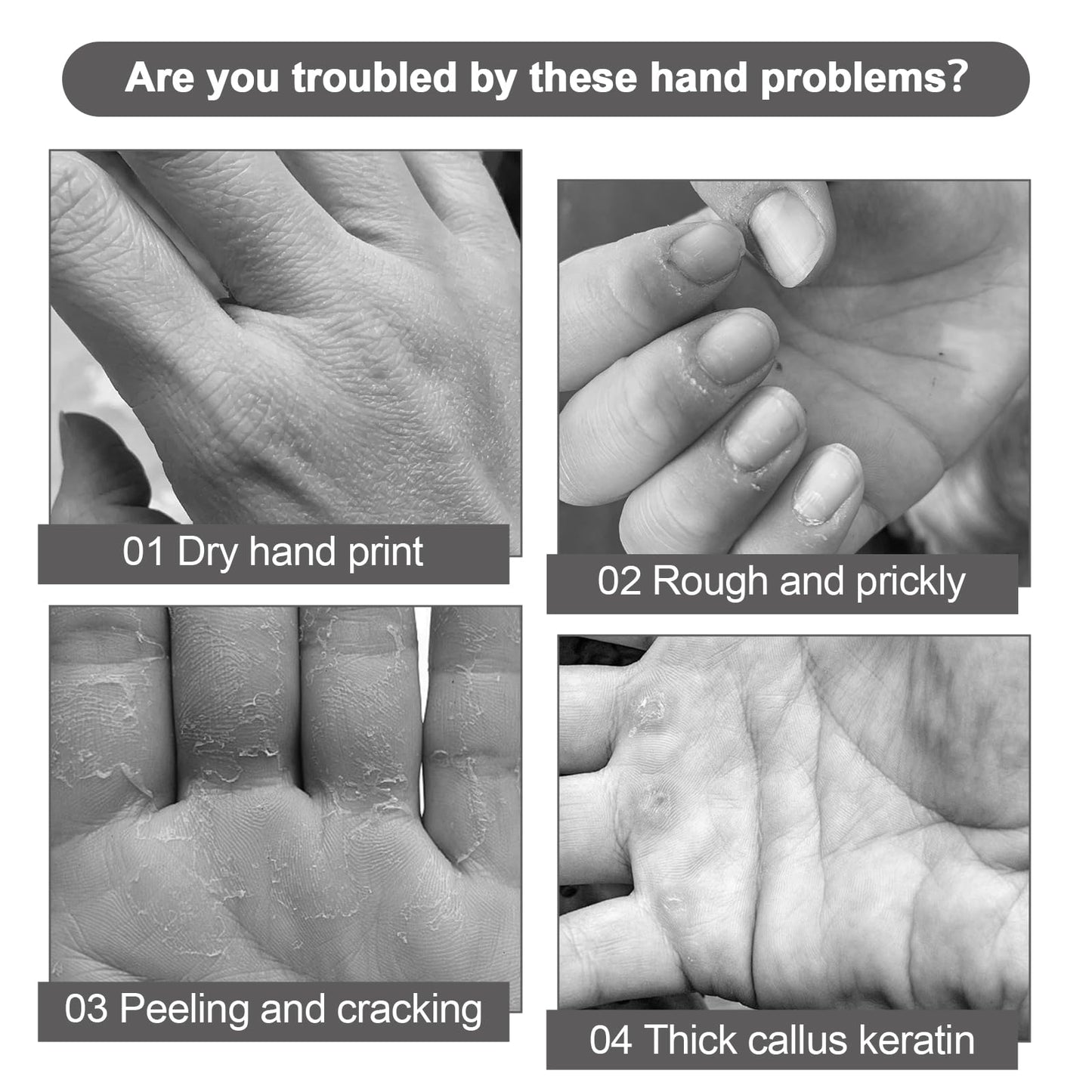 Samkeen Retinol Hand Cream, Anti Aging Hand Cream for Women & Men, Strong Soothing for Very Dry Hands, Deeply Moisturizes for Skin, Nails, Cuticles (2pcs)