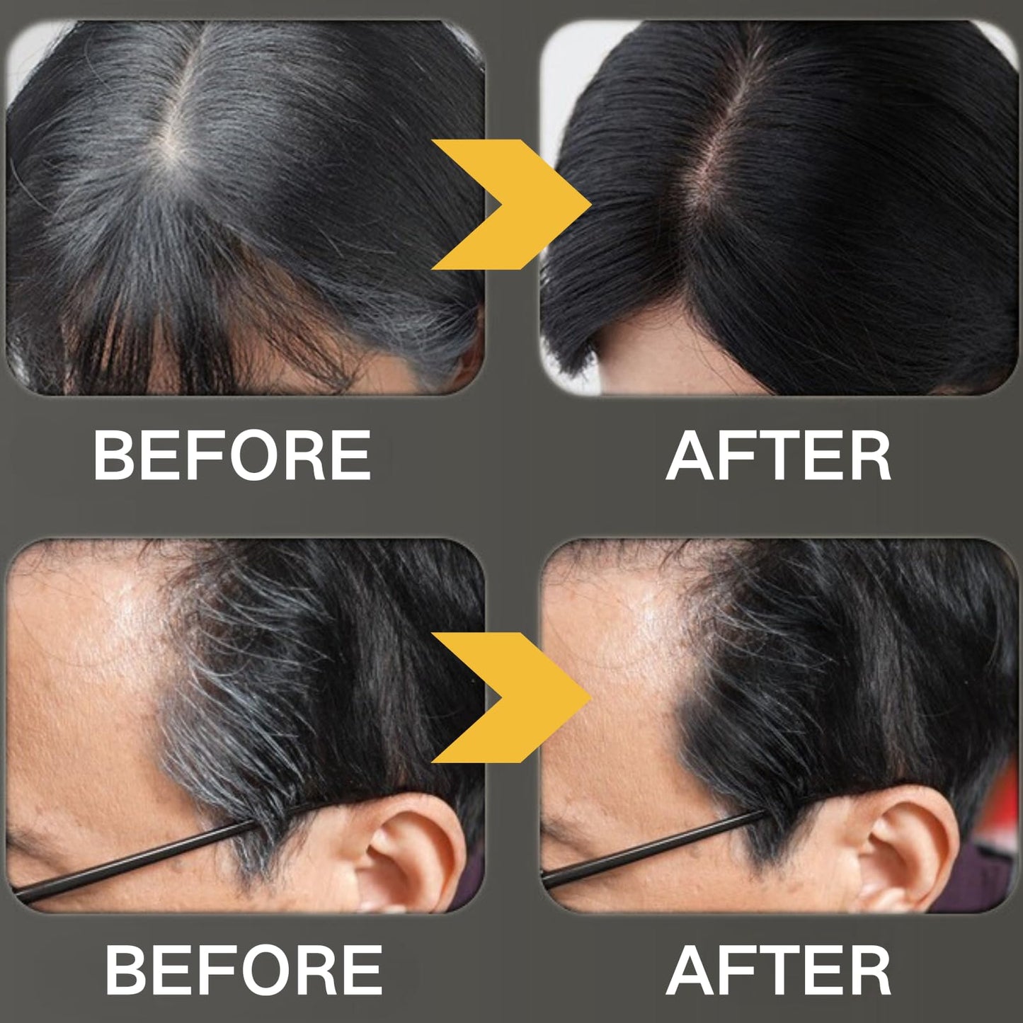 SHEBEEDO Safe and Convenient Hair Dye Comb, 2 in 1 Instant Black Hair Colour Root Touch-Up Stick with Comb Applicator for Gray Coverage,Safe and Convenient Portable Hair Dye Brush Applicator for Women & Men