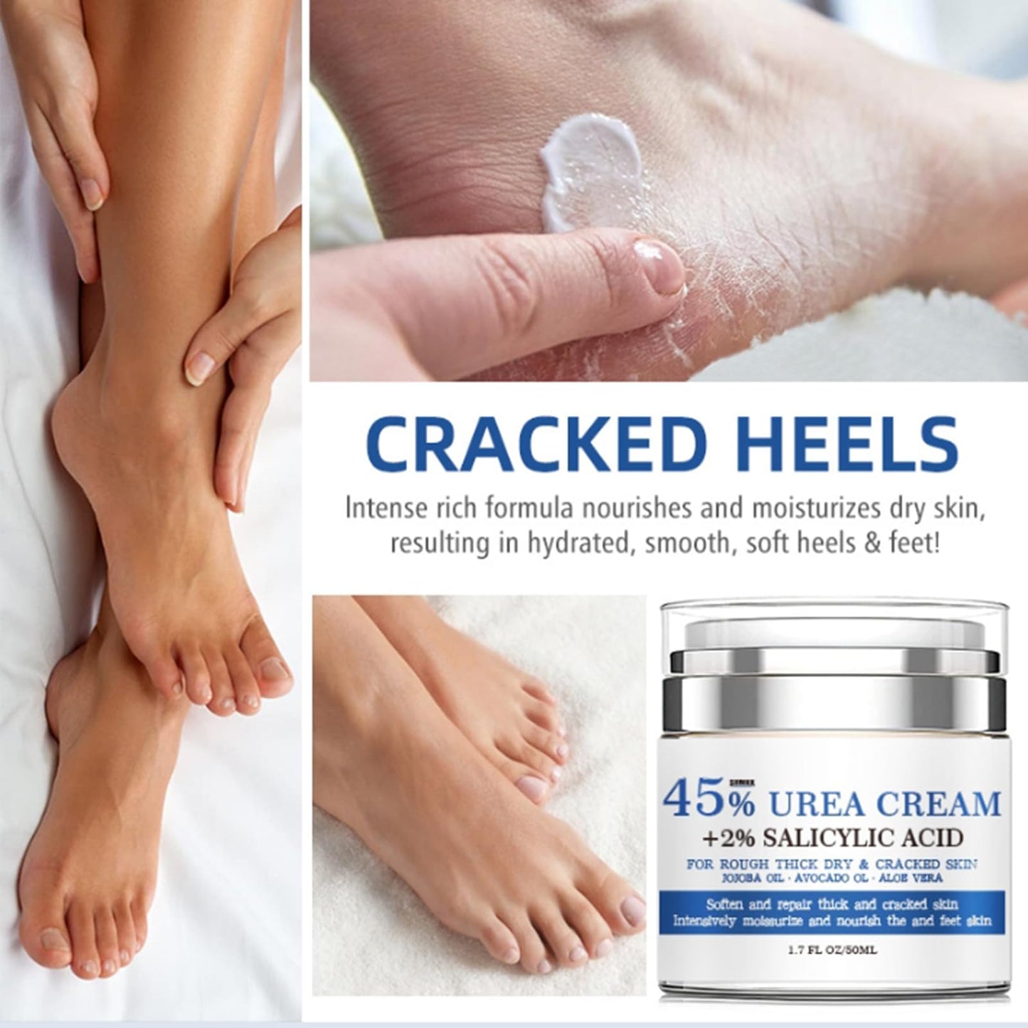 45% Urea Cream - Urea Foot Cream Plus 2% Salicylic Acid - Maximum Strength Urea Cream For Feet Nourish - Foot Urea Moisturiser For Dry Cracked Feet - Soften Calluse Foot Care Cream