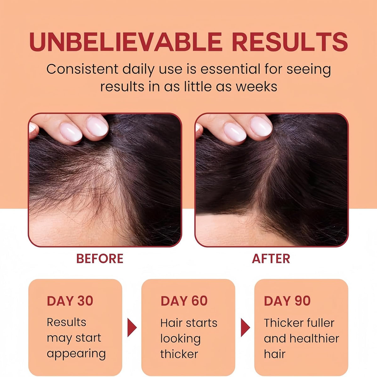 Luyrlix 100g Raw Batana Oils Paste for Hair Growth,Nourishing Hair Strengthener Oil,Raw Batana Oil Hair Mask,Moisturizes,Smooths and Shines,Improves Dryness and Frizziness,Treats Hair Men and Women,Gentle