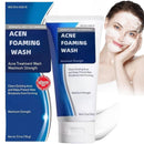 Acne Foaming Wash,Mild Daily Facial Cleanser for Deep Pore Cleansing,Acne Foa/m Wash,Gentle Daily Cleans/ing Foam,Clea/nsing Fo/am for Women,Facial Wash Women to Soothe Redness,Exfoliating Face Wash