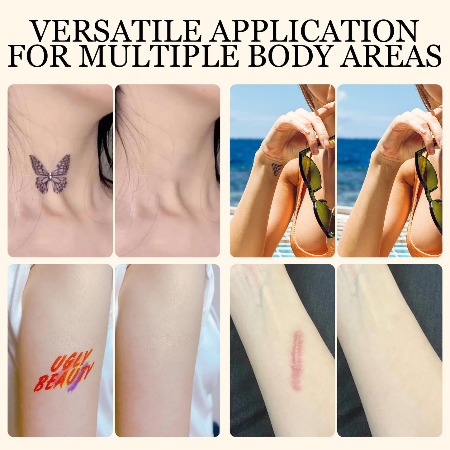 10 PCS Tato Cover up Patch,Ultra Thin Patch for Scar and Birthmarks,Scar Cover Stickers,Invisible Body Sticker for Scars,Invisible Waterproof Skin Tone Concealer Sticker,Covering Scars and Birthmarks