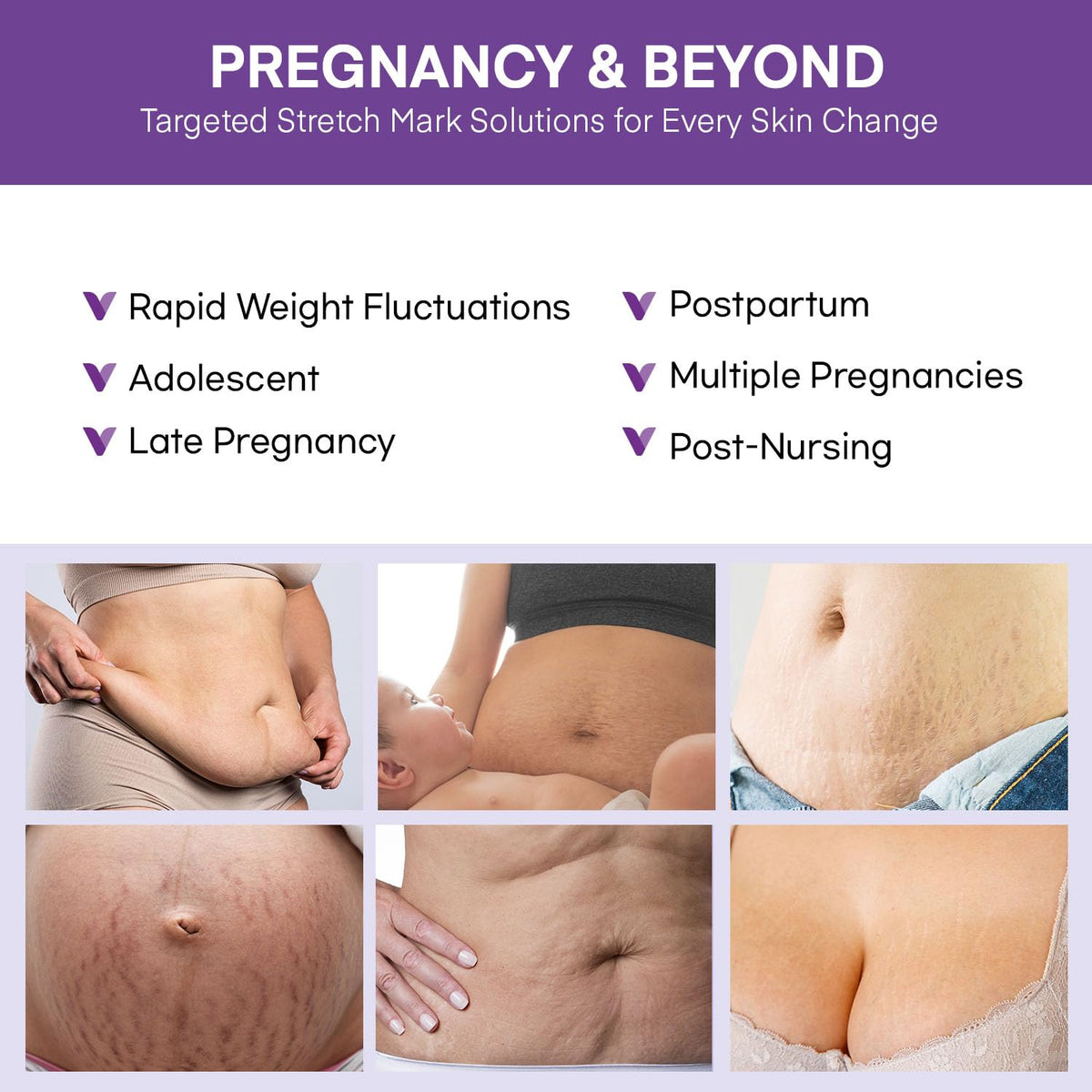 Vigority Stretch Mark Cream for Pregnant Women: Belly Butter for Expecting Moms - Moisturizing Lotion for Skin Elasticity - Maternity Skin Care Cream - 4 Oz