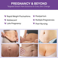 Vigority Stretch Mark Cream for Pregnant Women: Belly Butter for Expecting Moms - Moisturizing Lotion for Skin Elasticity - Maternity Skin Care Cream - 4 Oz