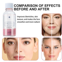 AuraAnge Zit - Targeting Serum - Face Serum for Blemish - Prone Skin, Helps Absorb Excess Oil, Suitable for Men and Women