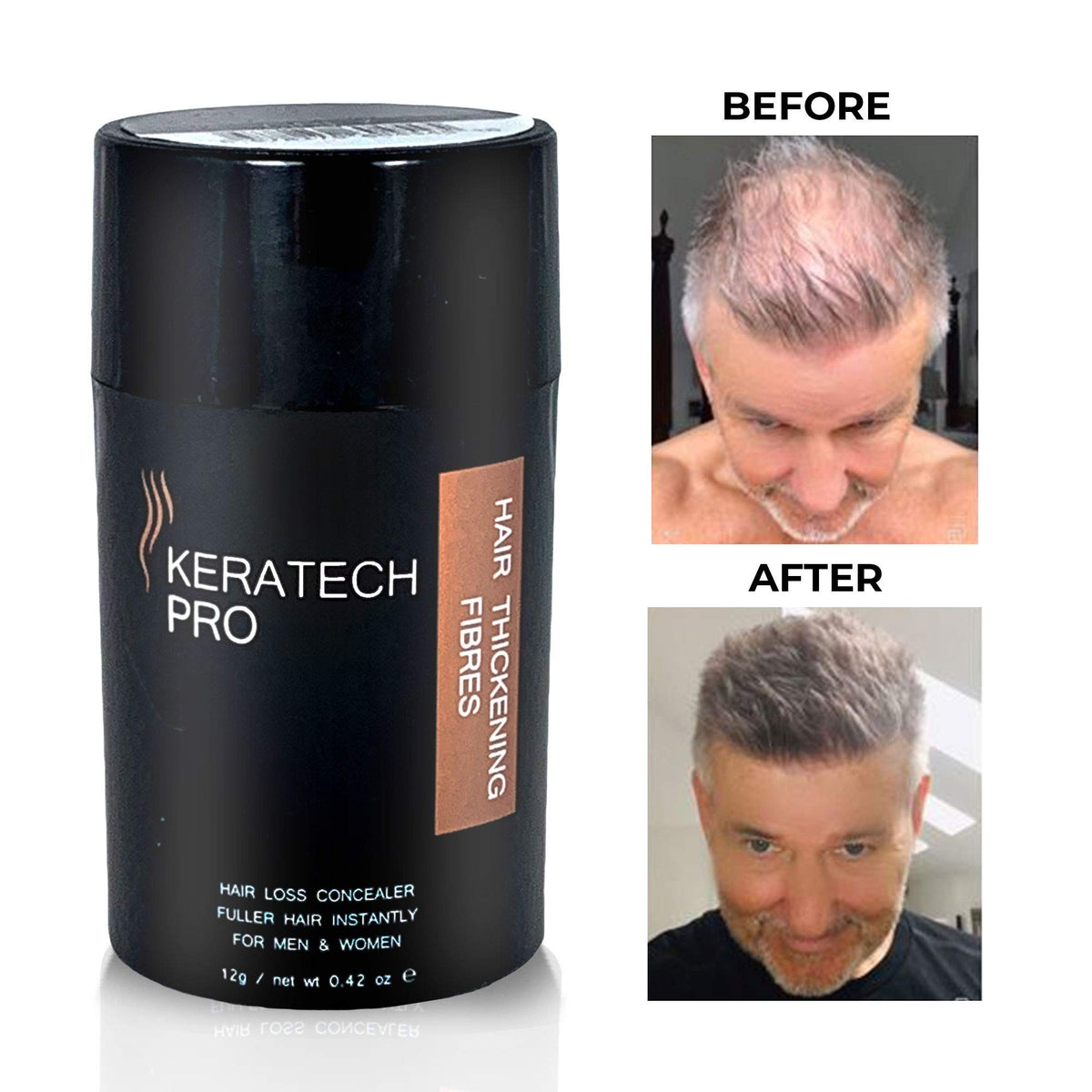 Hair Fibres by Keratech Pro 12ml | Instantly Fuller Hair | Advanced 100% Natural Keratin formula (Black)