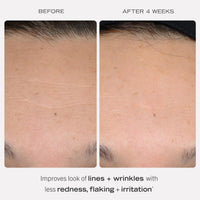 FIRST AID BEAUTY First Aid Beauty 0.3% Retinol Complex Serum with Peptides – Improves Look of Lines and Wrinkles with Less Irritation Than Traditional Retinol – 30 mL