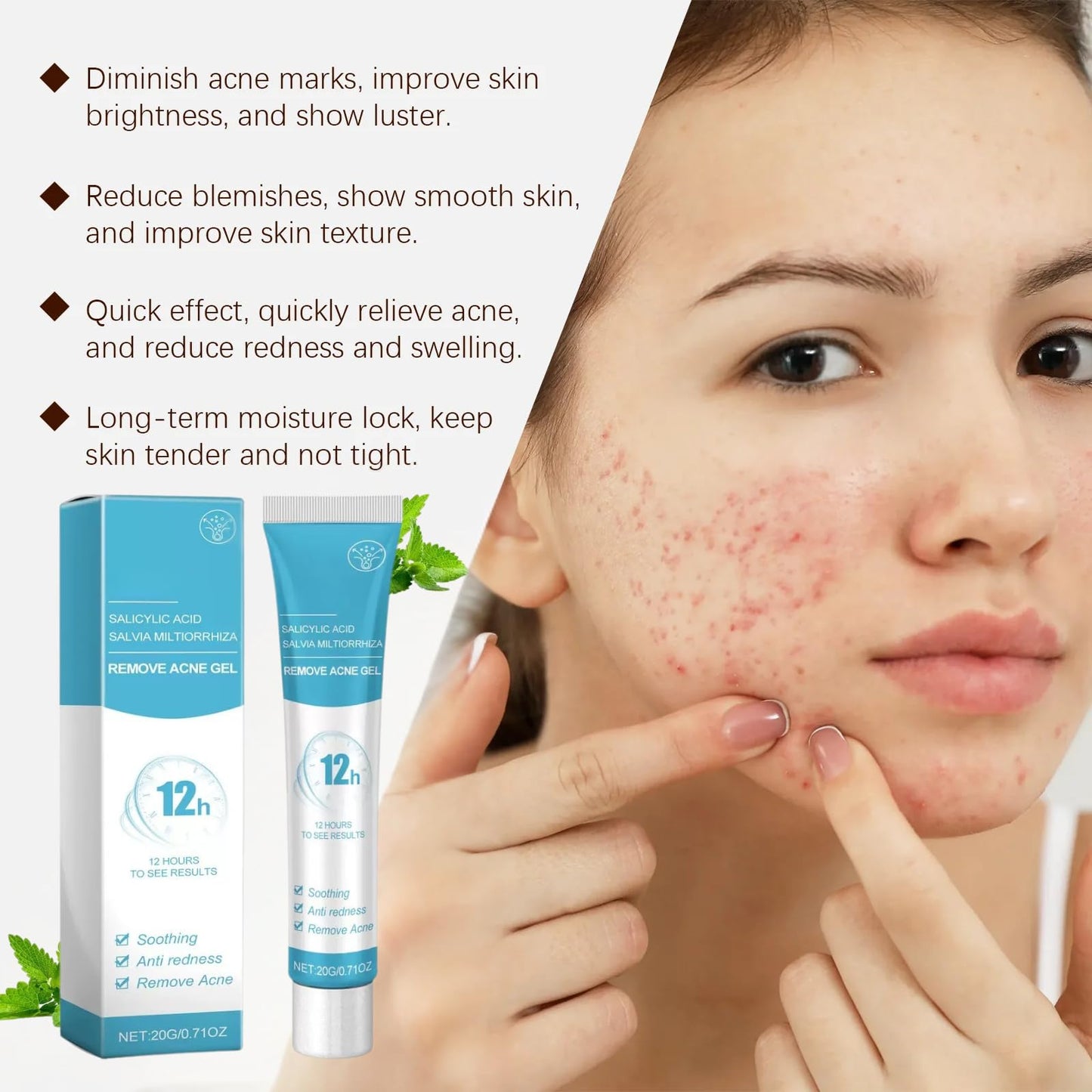 1PCS Acne treatment gel, Anti-Acne Cream, Spot Treatment Pimple Cream,Moisturizing gel for relieving and soothing redness, Acne treatment and spot treatment 20g.