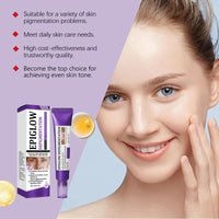 Wormeer Advanced Anti-Hyperpigmentation Cream - Skin Face Cream - Face Moisturisers, Improves Fine Lines, Even Out Skin-Tone, Suitable for All Skin Types - 20g