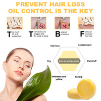 Samkeen Ginger Hair Shampoo Bar, Ginger Shampoo Bar, Ginger Shampoo Soap, Natural Organic Ginger Shampoo Soap for All Hair Types, Moisturize Hair and Control Oil (2pcs Ginger)